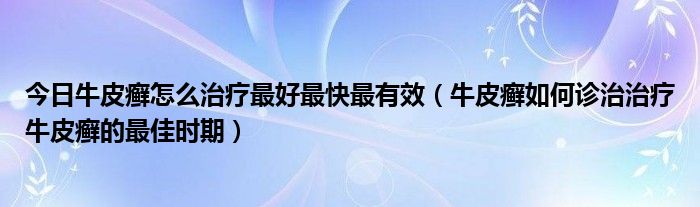 今日牛皮癣怎么治疗最好最快最有效(牛皮癣如何诊治治疗牛皮癣的最佳时期)