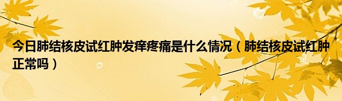 今日肺结核皮试红肿发痒疼痛是什么情况(肺结核皮试红肿正常吗)
