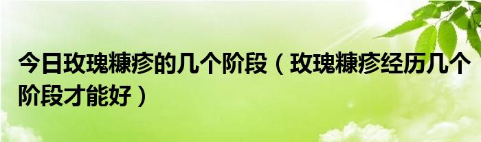 今日玫瑰糠疹的几个阶段(玫瑰糠疹经历几个阶段才能好)