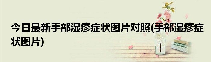今日最新手部湿疹症状图片对照(手部湿疹症状图片)