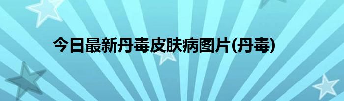 今日最新丹毒皮肤病图片(丹毒)