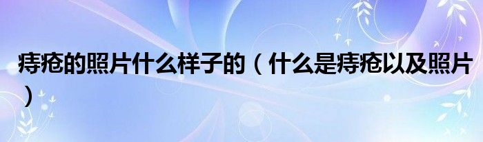 痔疮的照片什么样子的（什么是痔疮以及照片）