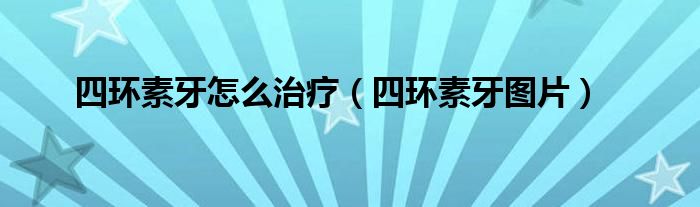 四环素牙怎么治疗(四环素牙图片)