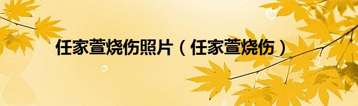 任家萱烧伤照片(任家萱烧伤)