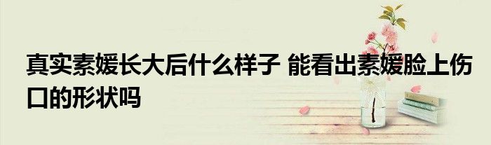 真实素媛长大后什么样子 能看出素媛脸上伤口的形状吗